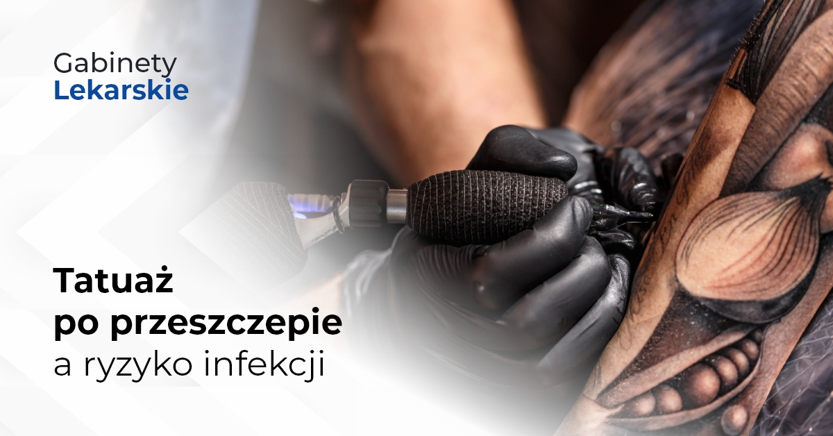 Tatuaż po przeszczepie a ryzyko infekcji